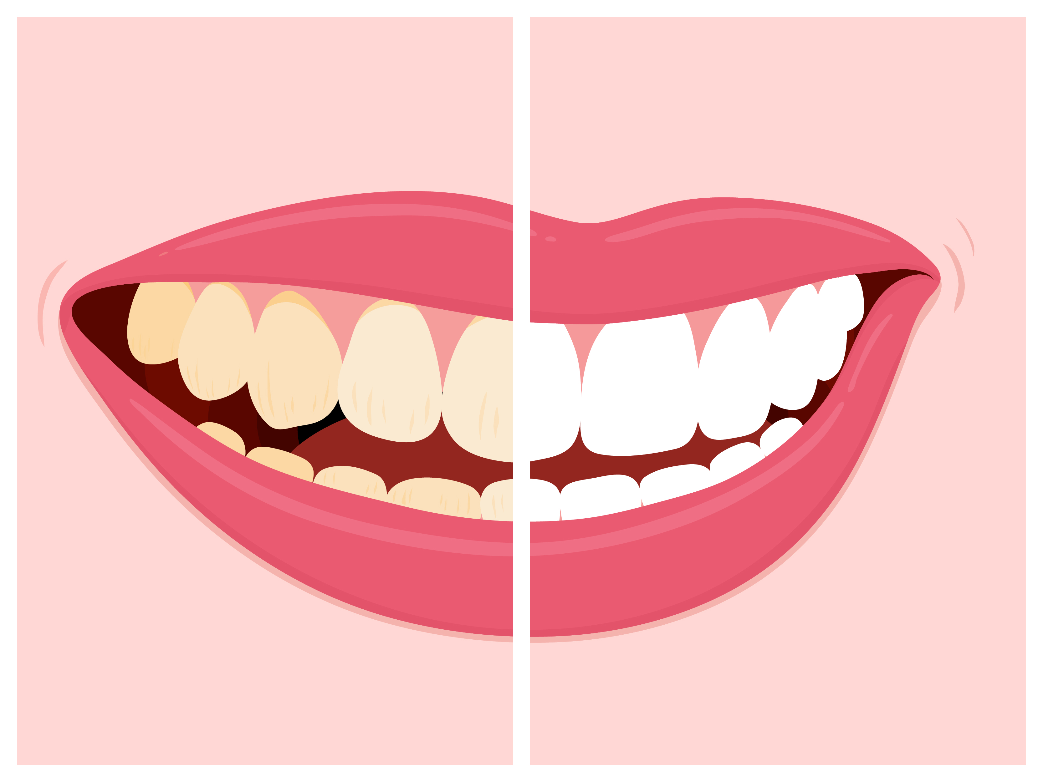 How Red Wine and Coffee Stain Your Teeth and 4 Things to do to Prevent it! London Holistic Dental